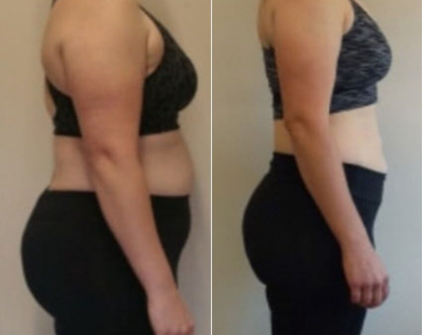 Stronger back sustainable weight loss