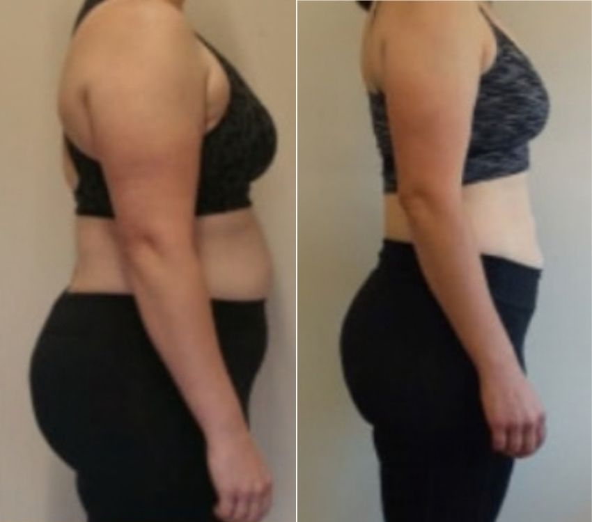 Vicky back pain sustainable weight loss